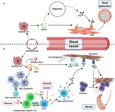 Classical Disease-Specific Autoantibodies in Systemic Sclerosis: Clinical Features, Gene Susceptibility, and Disease Stratification